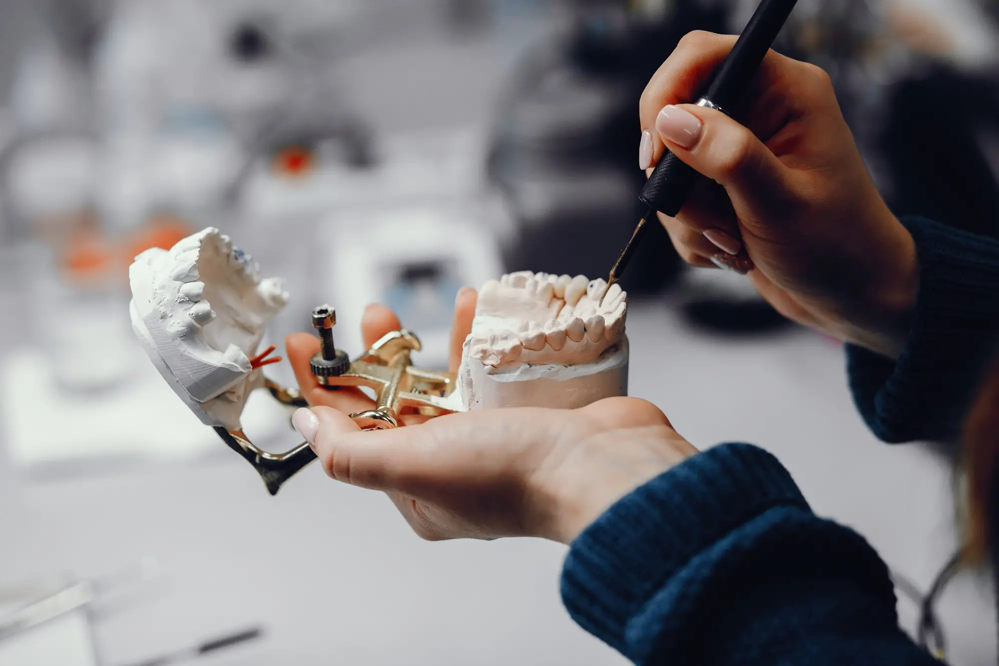Clinical Case – 10 Dental Implants